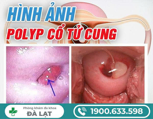 Hình ảnh minh họa